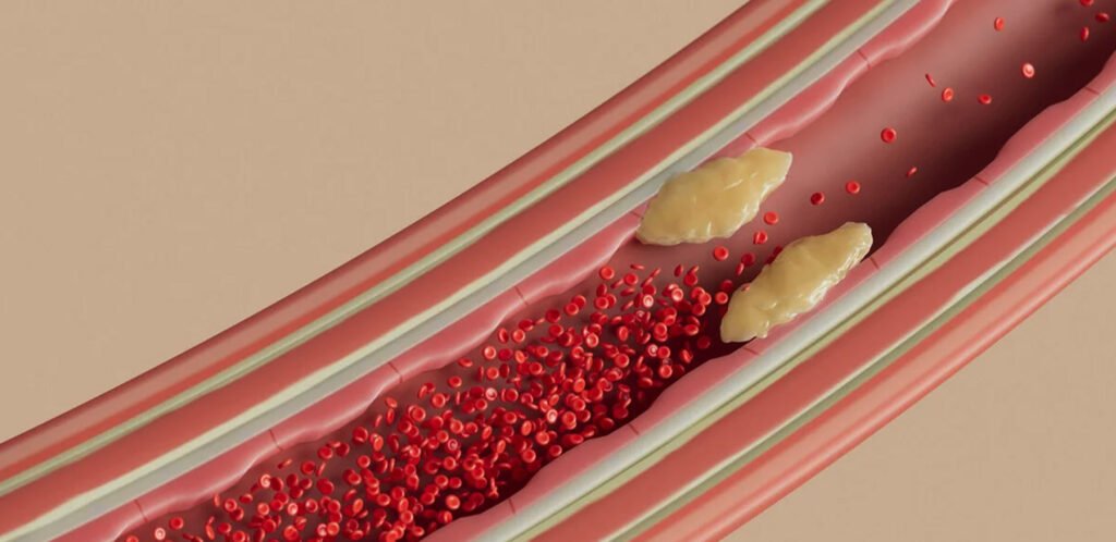 Vascular Health and Arteries
